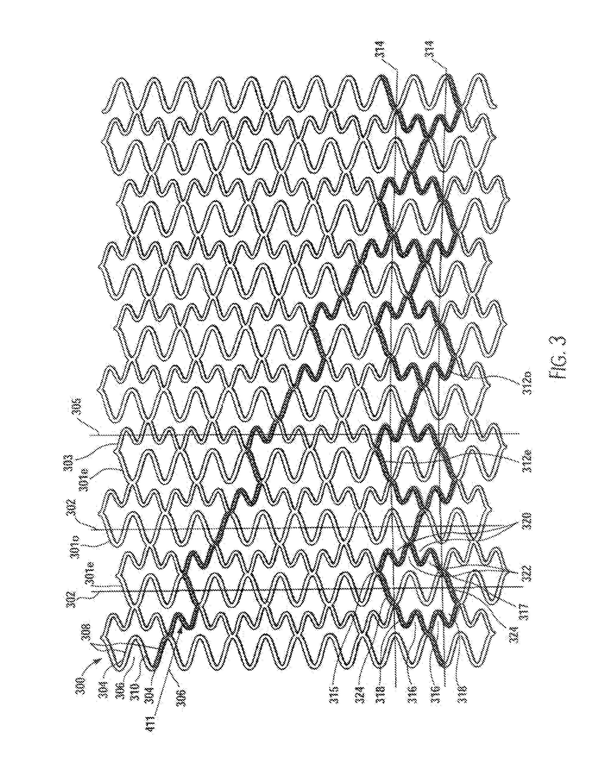 Longitudinally flexible stent