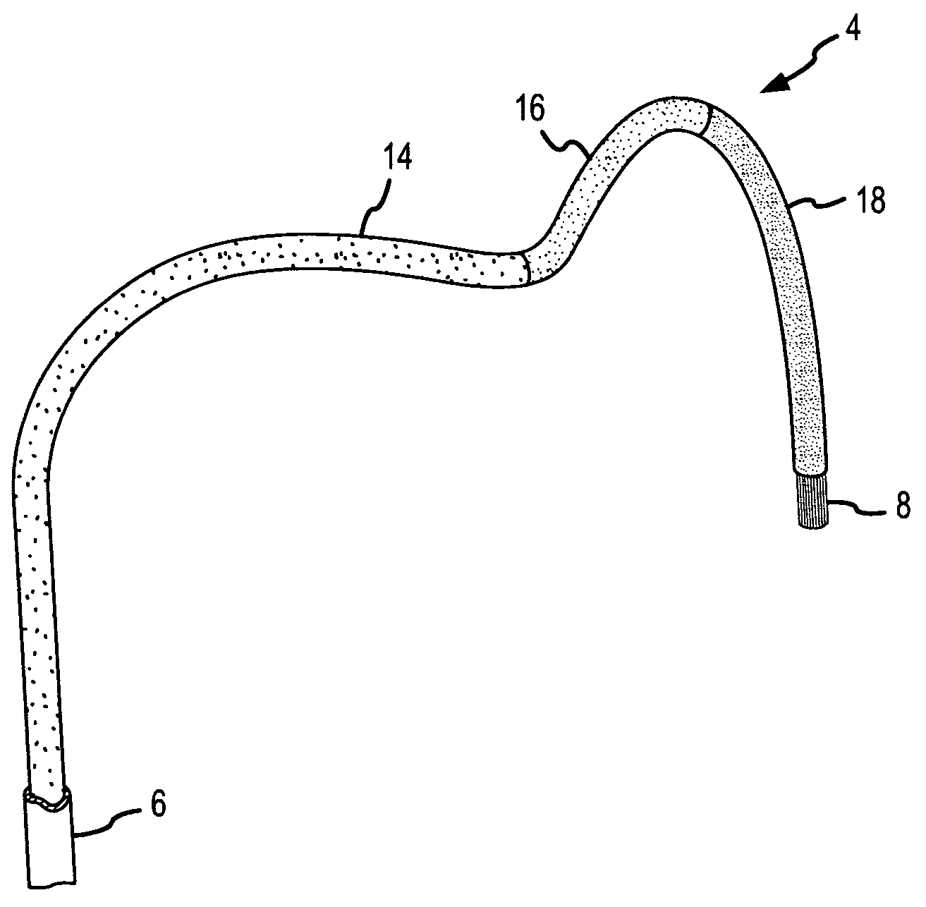 Ablation catheter with suspension system incorporating rigid and flexible components