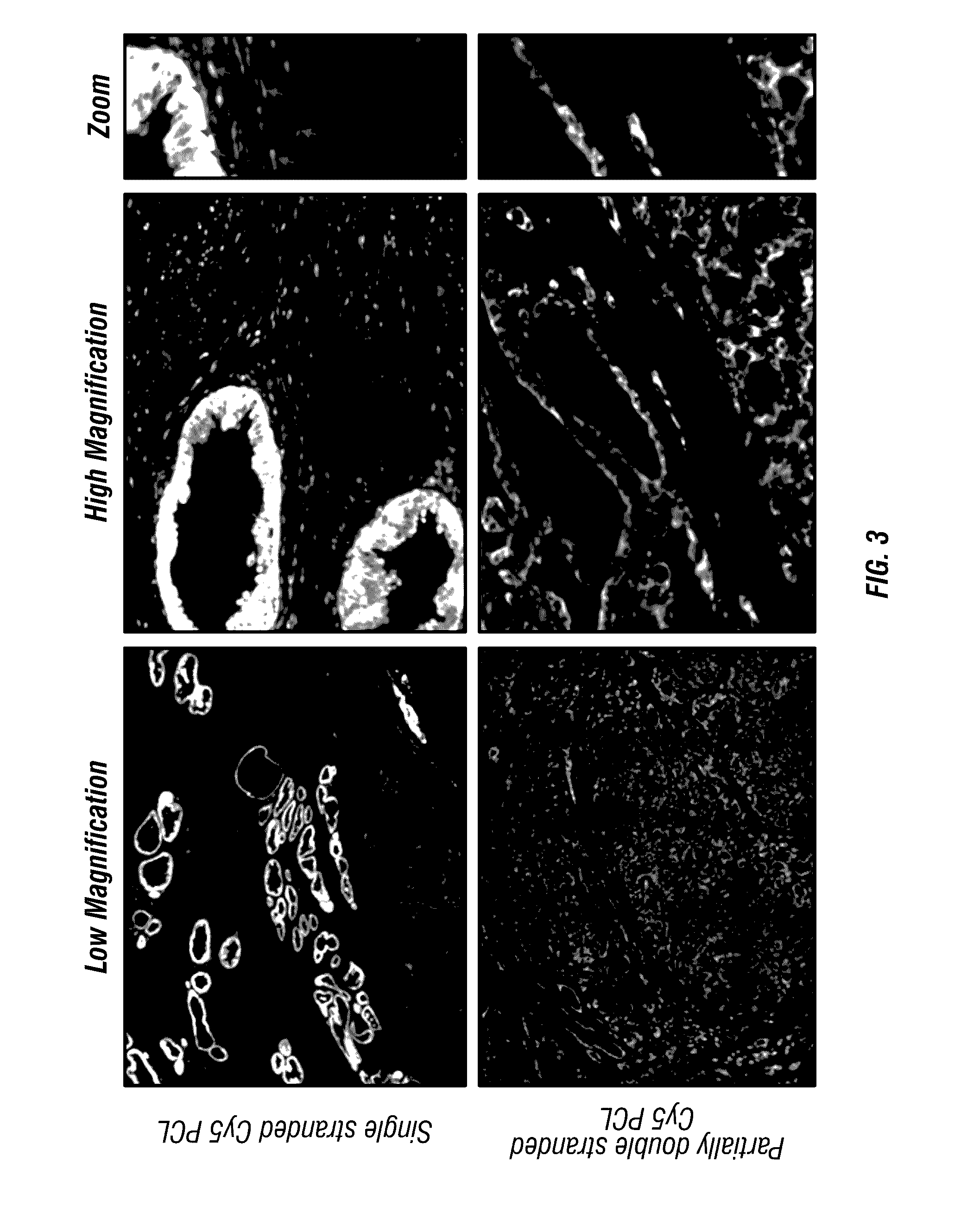 Antigen detection using photocleavable labels