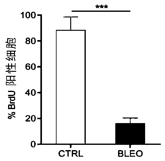 Anti-aging medicine D/A targeting at aging cells in tissue microenvironment and application of anti-aging medicine D/A