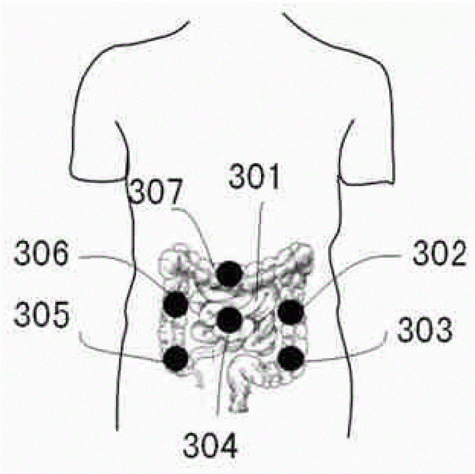 A sound sensor, an electroenterogram detection system and detection method based on the sound sensor