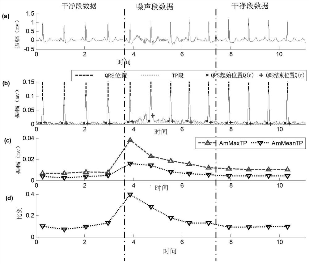 ECG noise recognition model training and ECG noise detection method and device