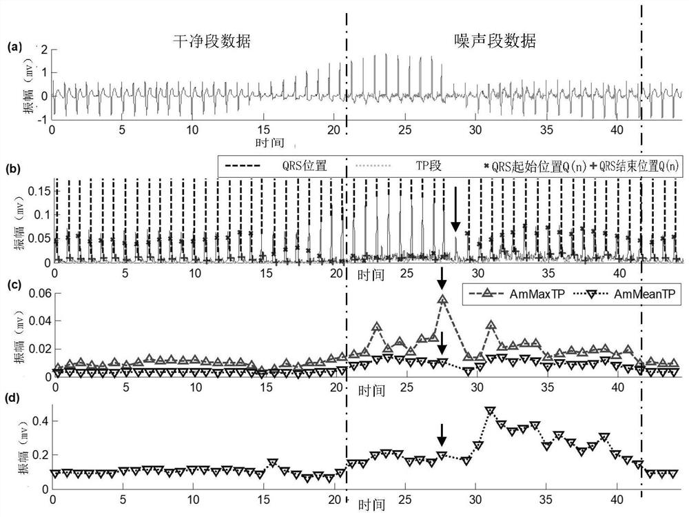 ECG noise recognition model training and ECG noise detection method and device