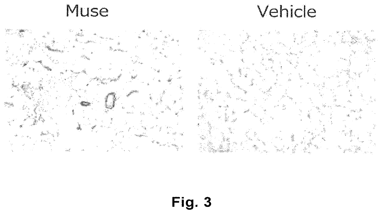 Therapeutic agent of peripheral blood flow disorder