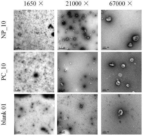 Exosome preparation method and application