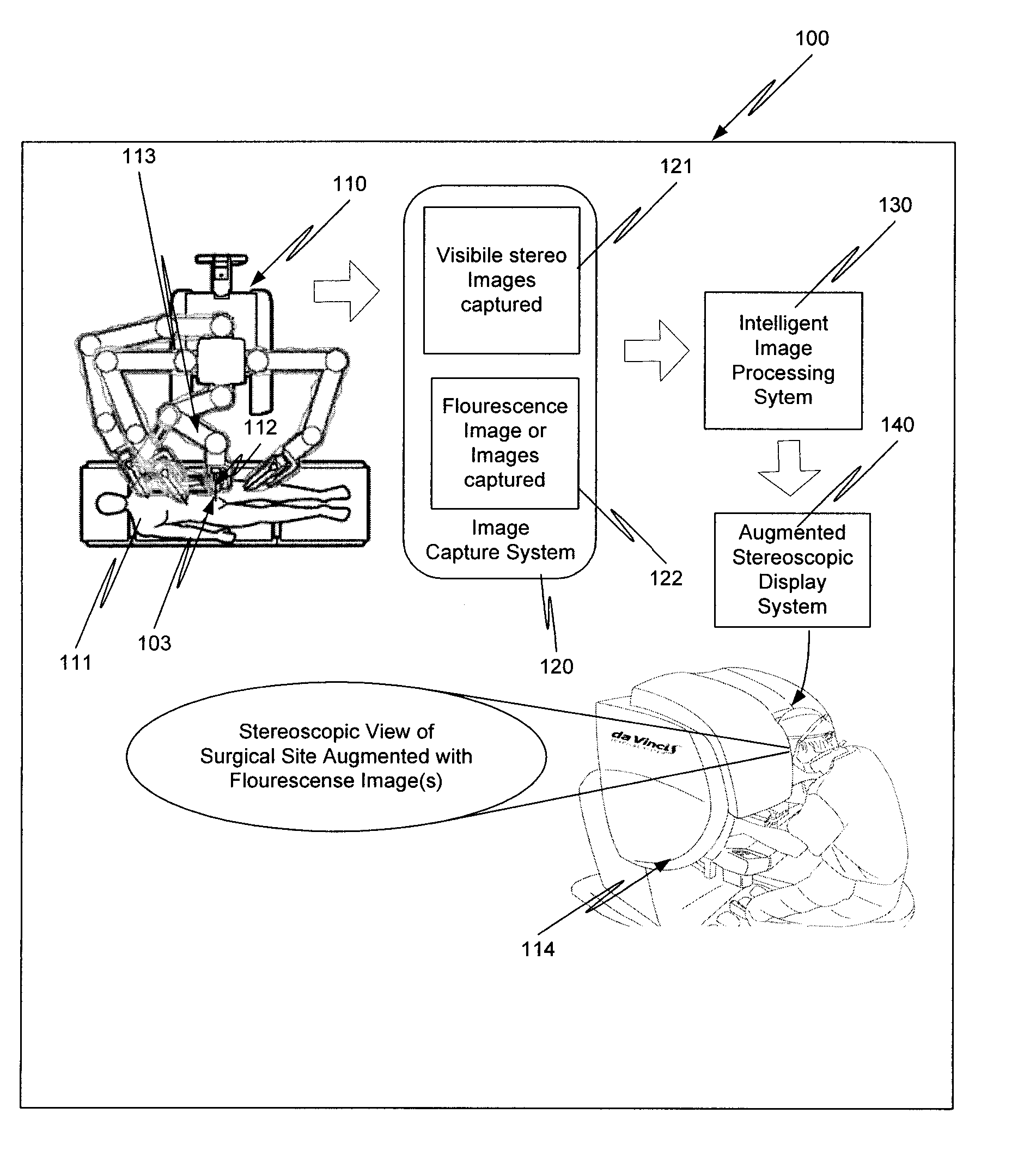 Augmented stereoscopic visualization for a surgical robot using a captured visible image combined with a fluorescence image and a captured visible image