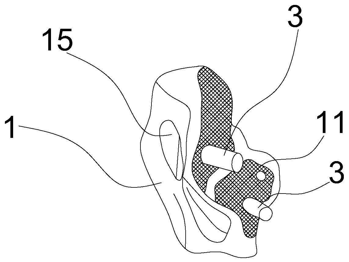 Individual all-talus prosthesis having biological functions and making method of individual all-talus bone prosthesis