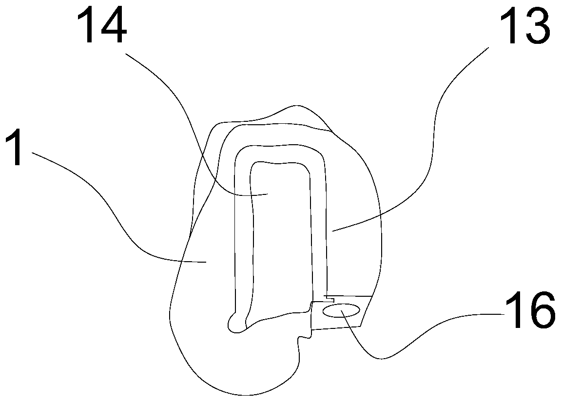 Individual all-talus prosthesis having biological functions and making method of individual all-talus bone prosthesis