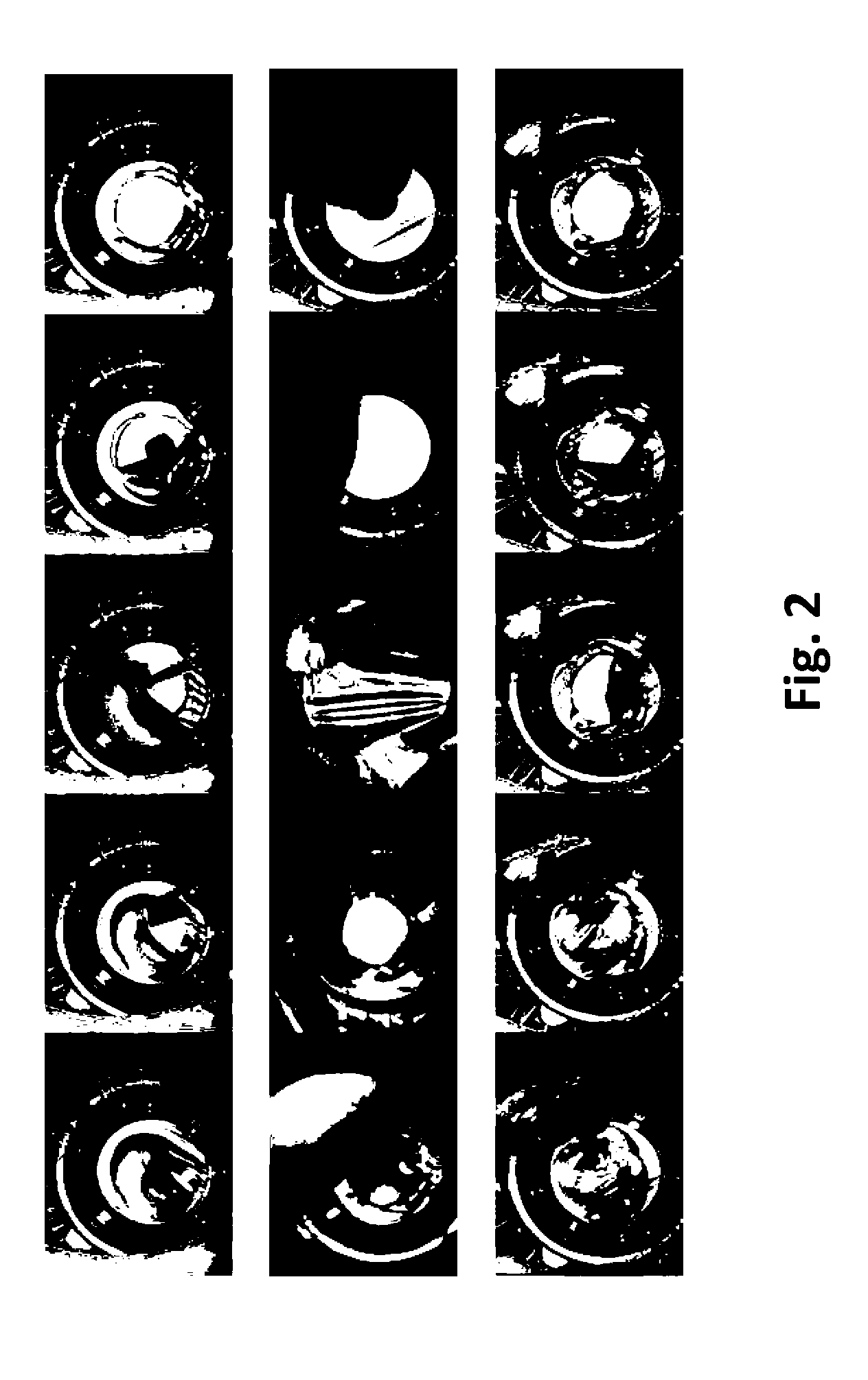 Computer Vision Based Method And System For Evaluating And Grading Surgical Procedures