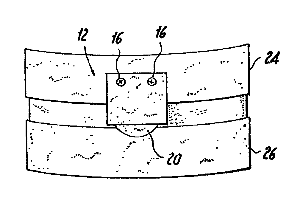 Implant retaining device