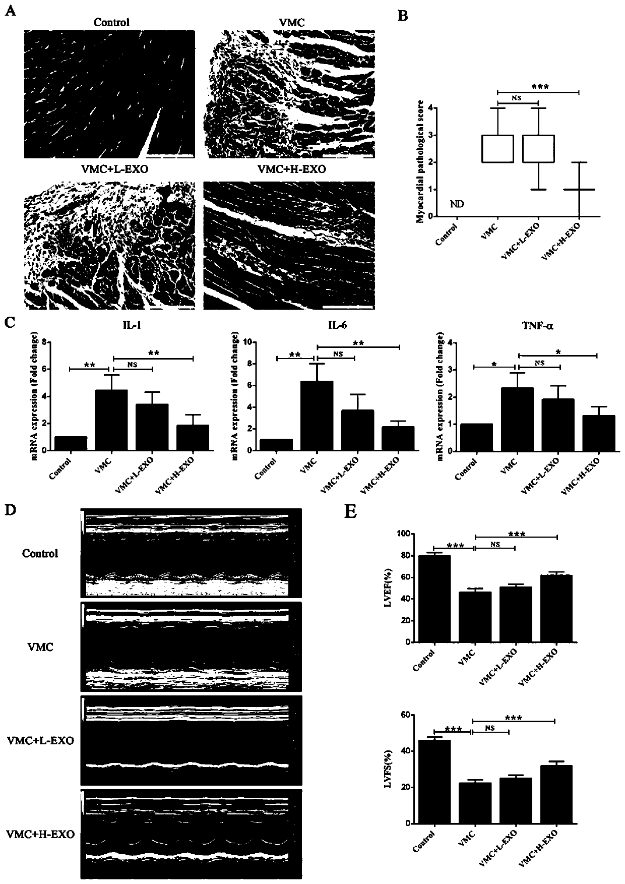 Exosome derived from human umbilical cord mesenchymal stem cells, and identification method and application of exosome