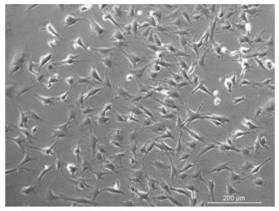 Mesenchymal stem cell membrane camouflaged magnetic drug-loaded nanoparticles as well as preparation method and application thereof