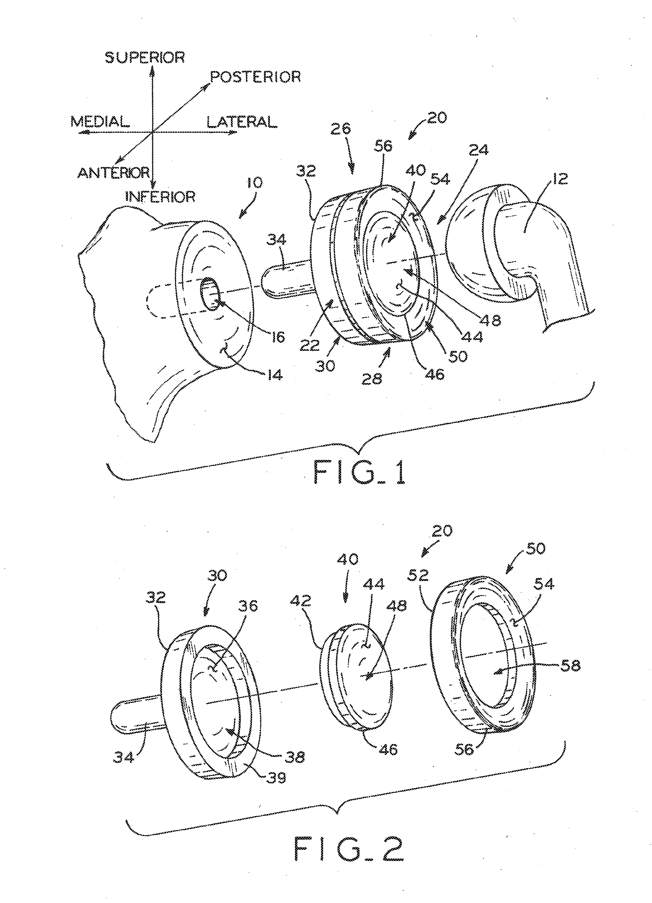 Glenoid implant with synthetic labrum