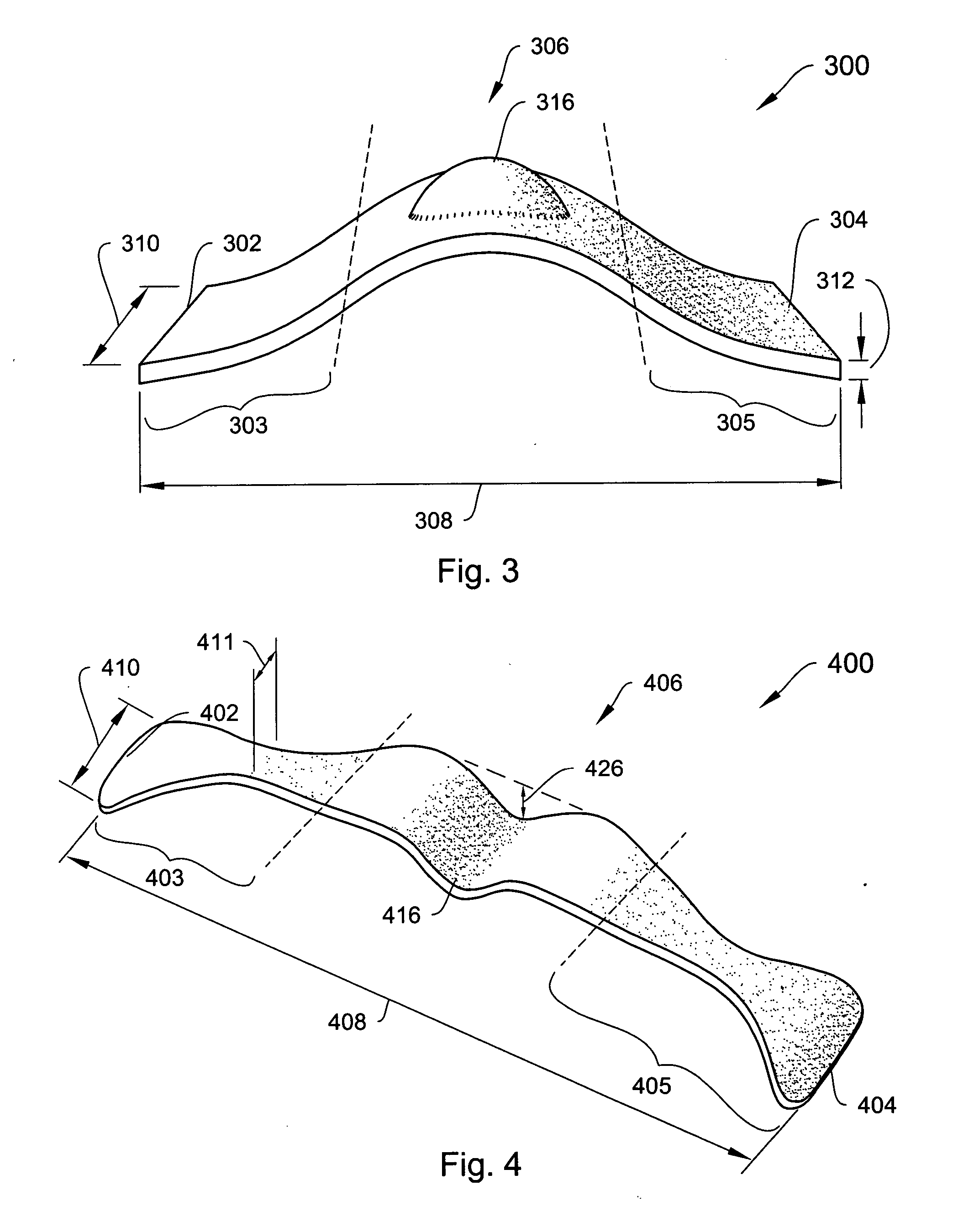 Systems, devices and methods relating to a shape resilient sling-like support for treating urinary incontinence