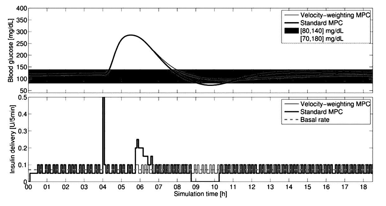 Velocity-weighting model predictive control of an artificial pancreas for type 1 diabetes applications