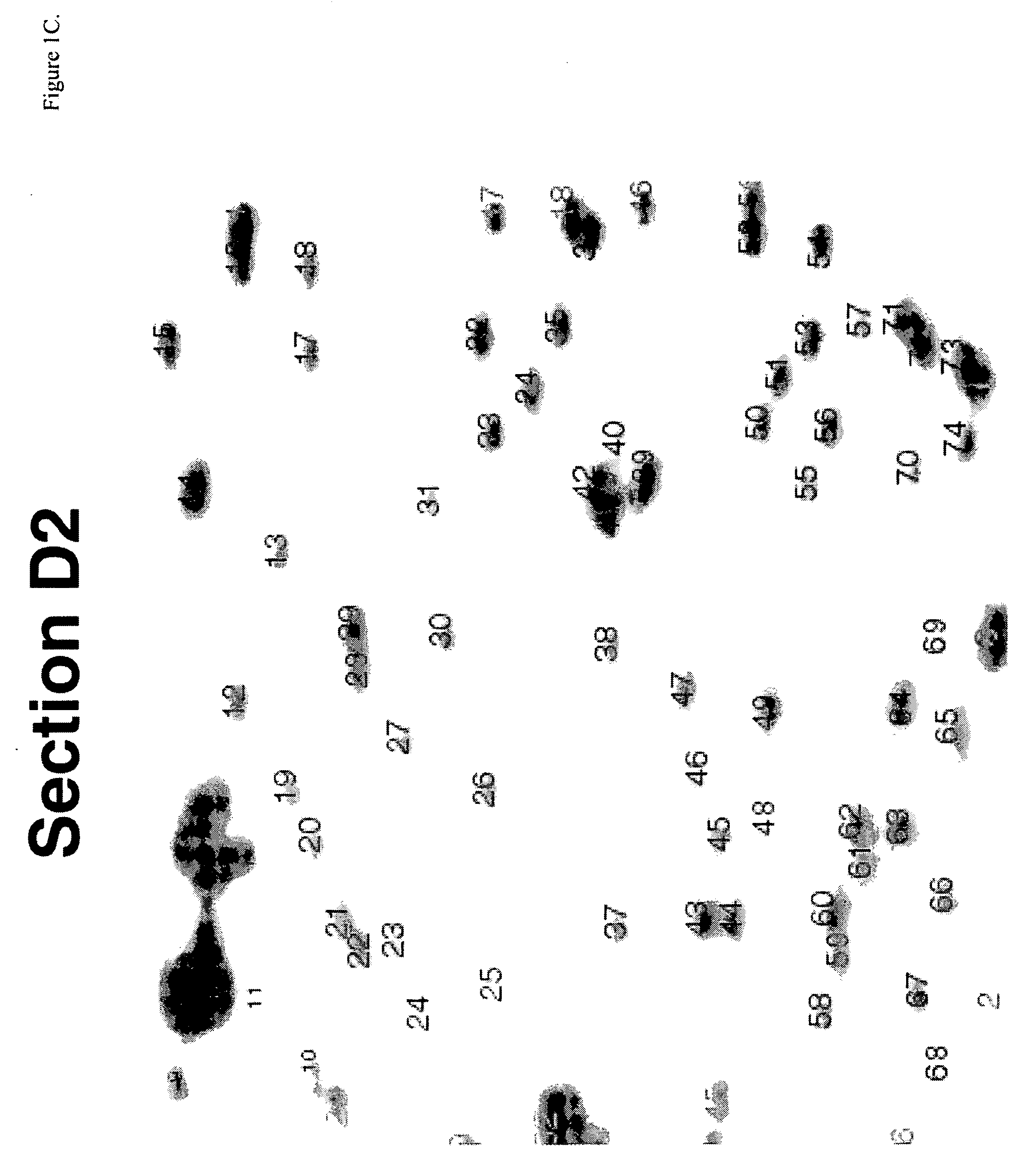 Detection of methylated CpG rich sequences diagnostic for malignant cells