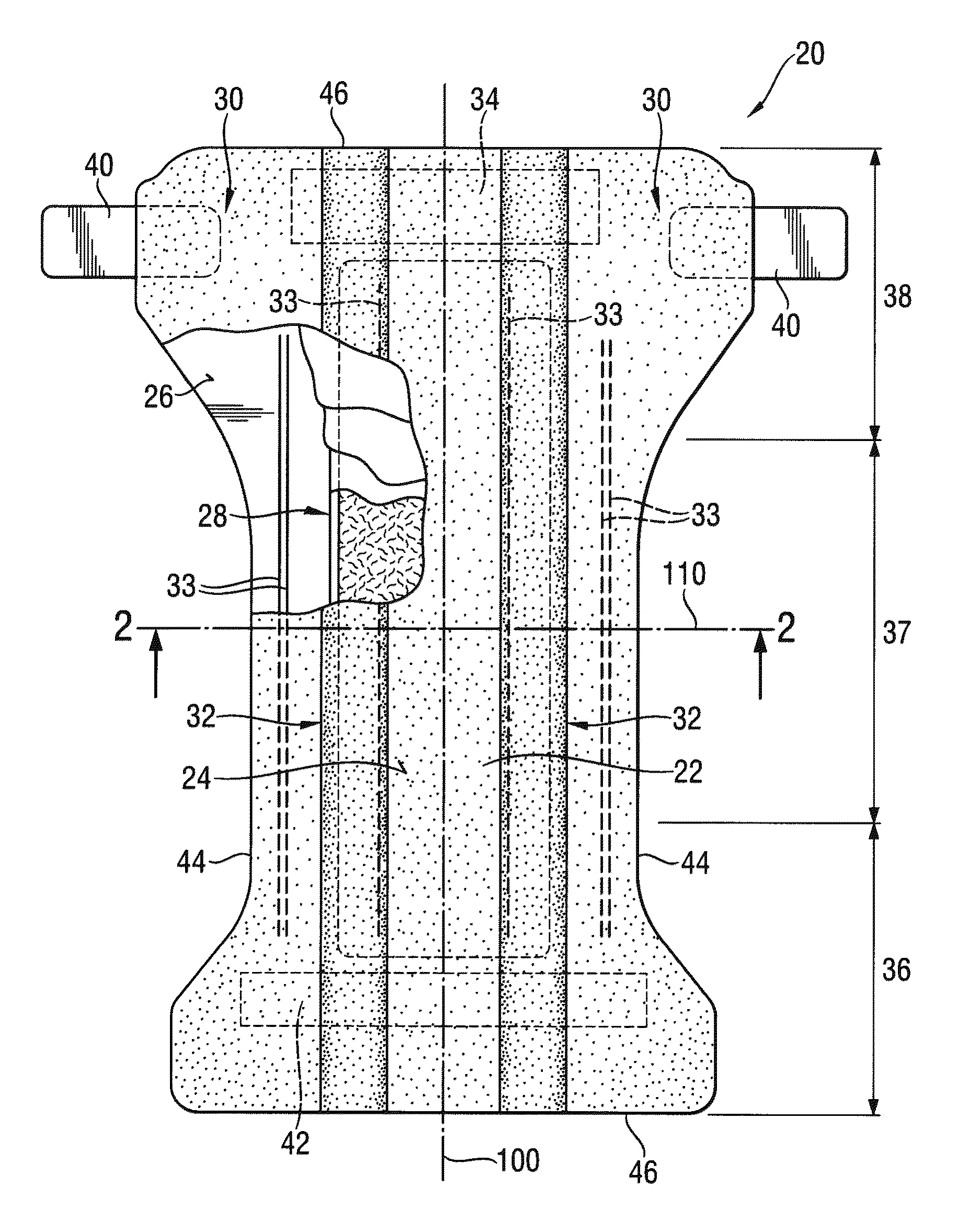 Surface Cross-Linked Superabsorbent Polymer Particles and Methods of Making Them