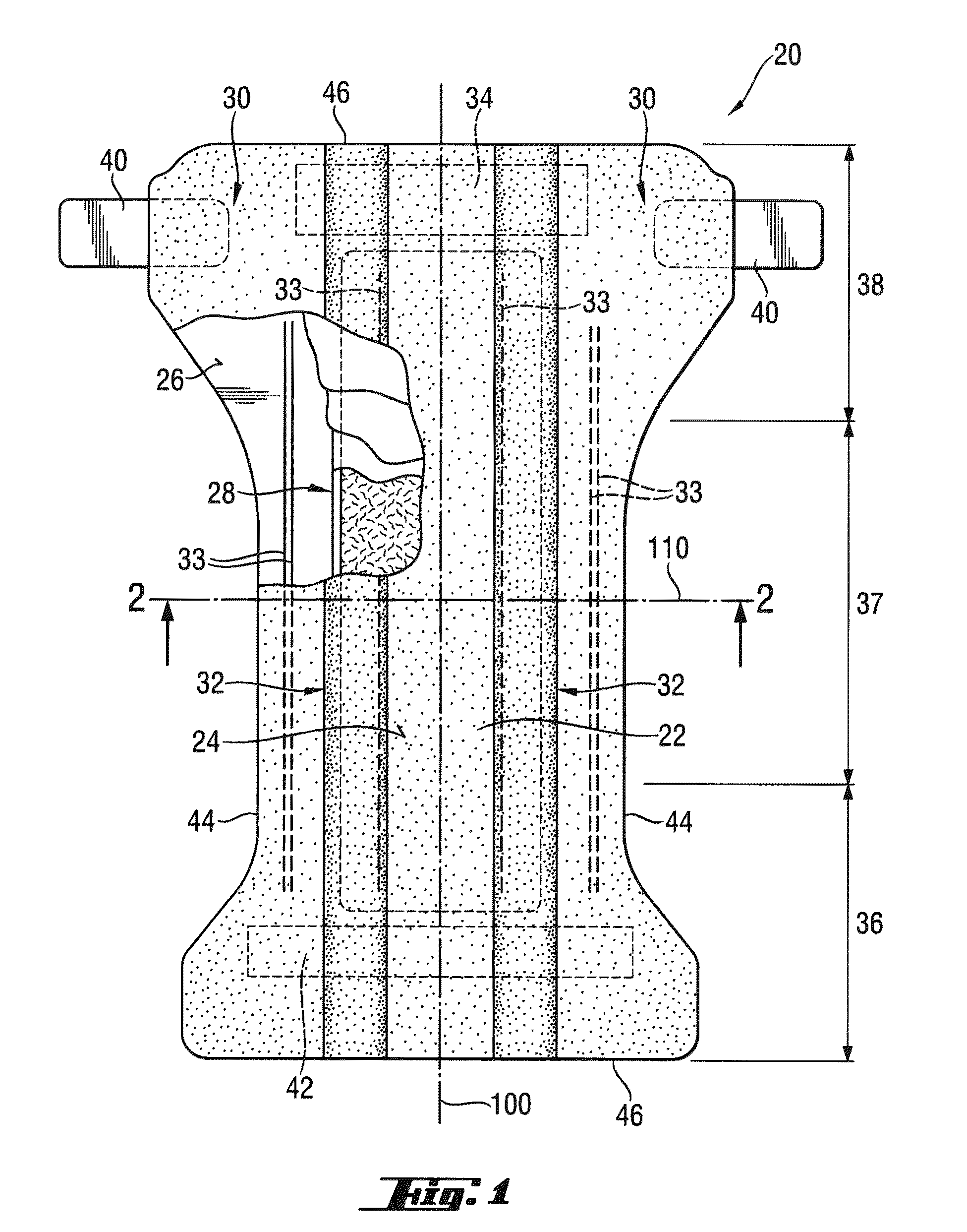 Surface Cross-Linked Superabsorbent Polymer Particles and Methods of Making Them