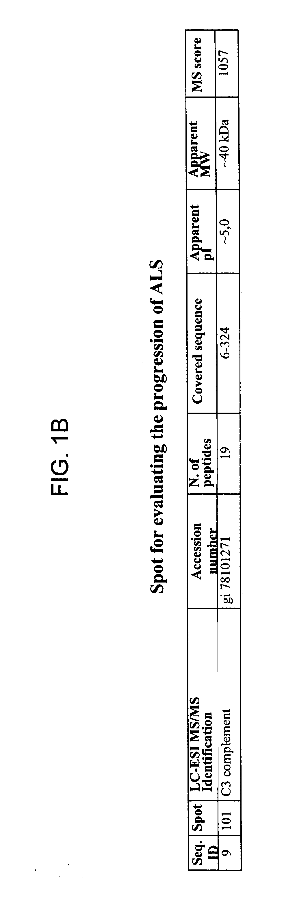 Biomarkers for diagnosing and detecting the progression of neurodegenerative disorders, in particular of amyotrophic lateral sclerosis