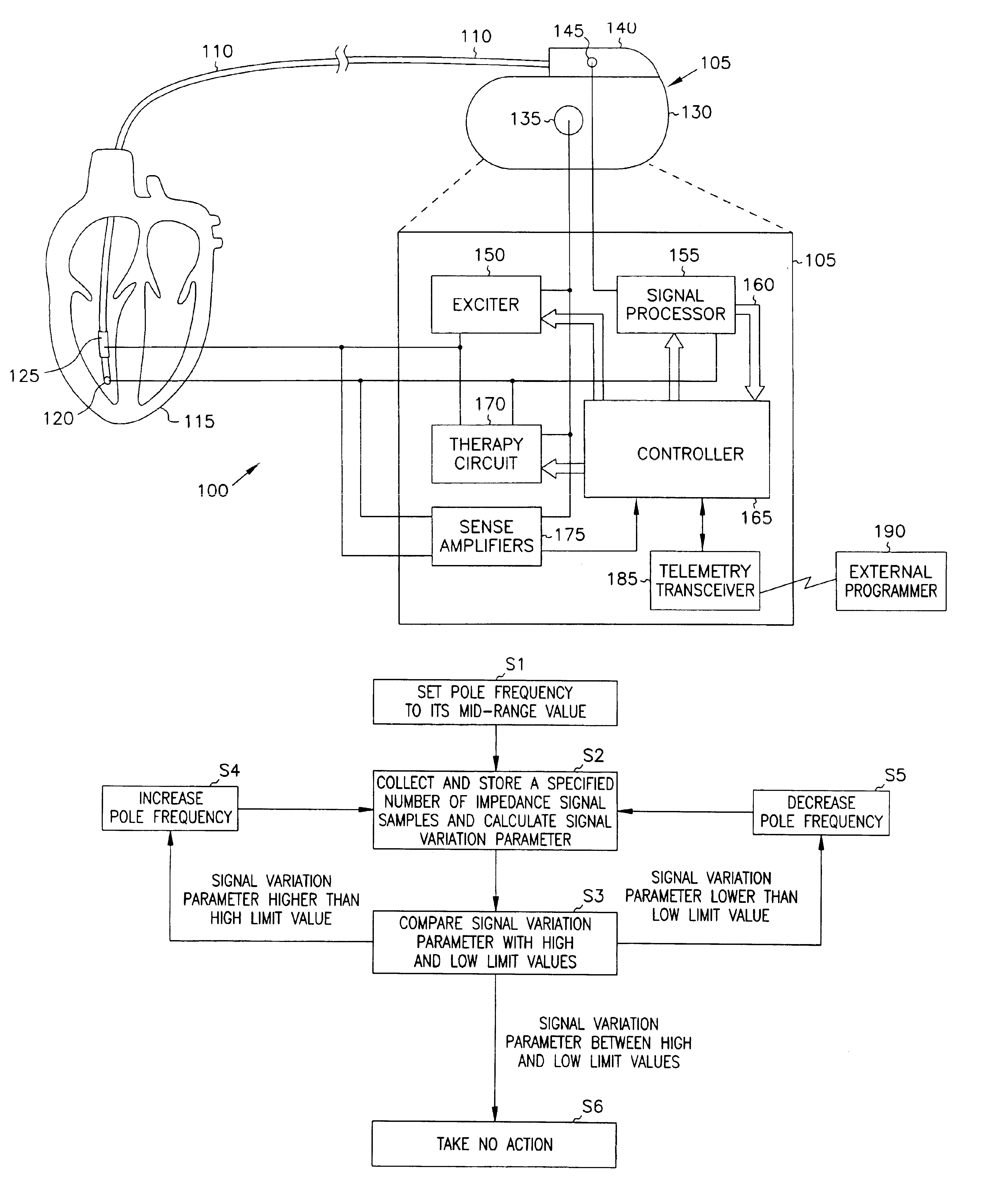 Minute ventilation sensor with automatic high pass filter adjustment