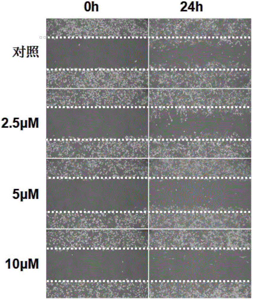 Myricetin extract, medicine composition containing myricetin extract and purposes thereof