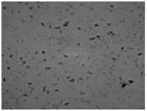 Denitrifying bacterium and application thereof