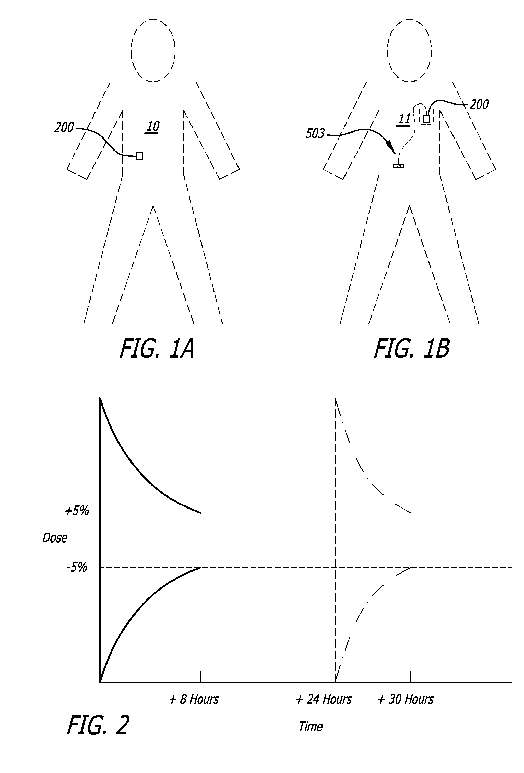 Infusion pumps