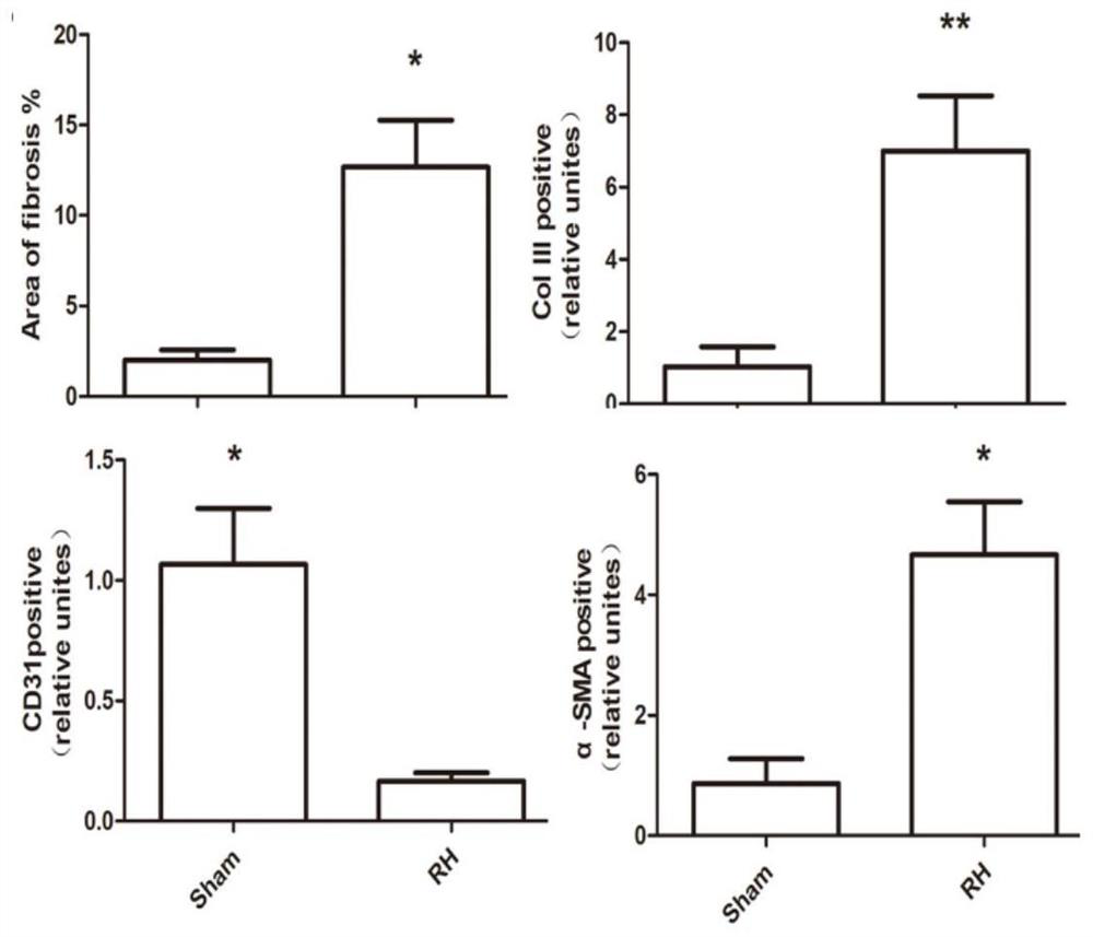 Application of miR-122-5p as renal fibrosis non-invasive diagnostic marker and detection kit