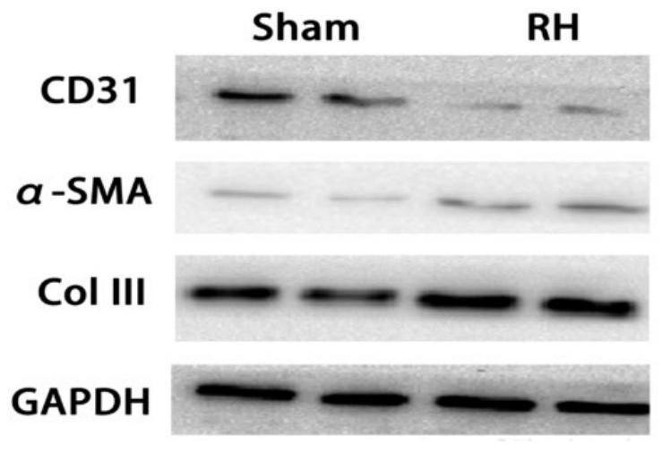 Application of miR-122-5p as renal fibrosis non-invasive diagnostic marker and detection kit