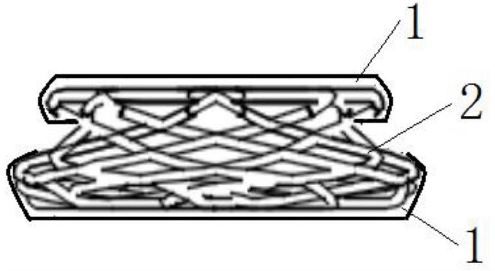 A degradable drug-loaded occluder, forming and unfolding method of the occluder