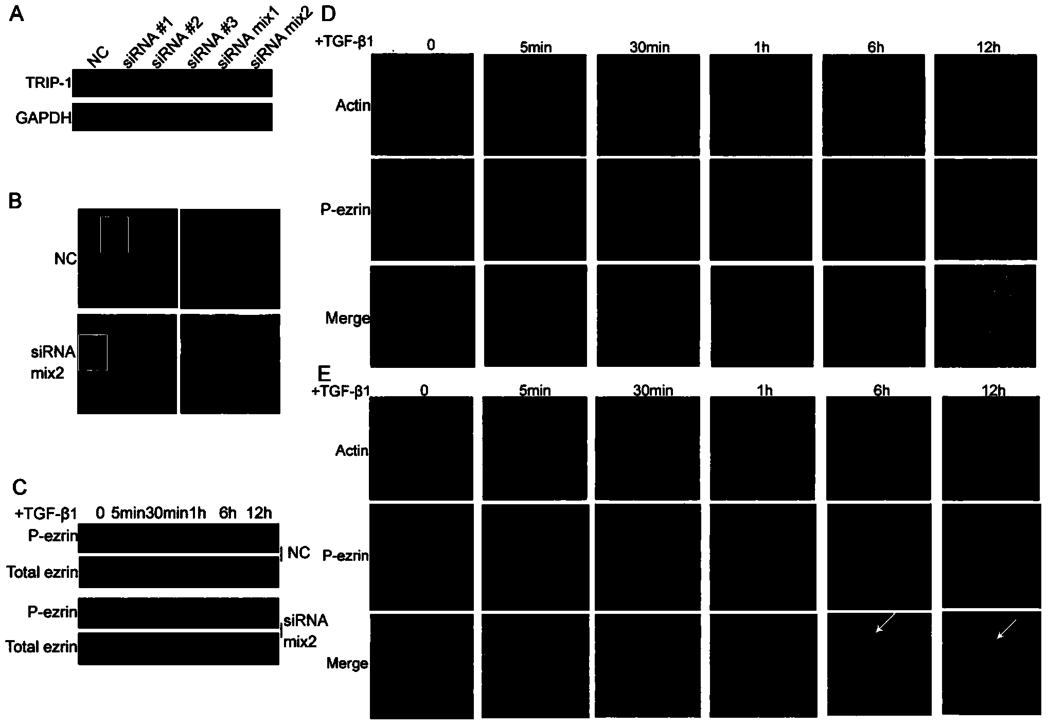 Novel use of TGF (Transforming Growth Facto)-beta receptor binding protein-1