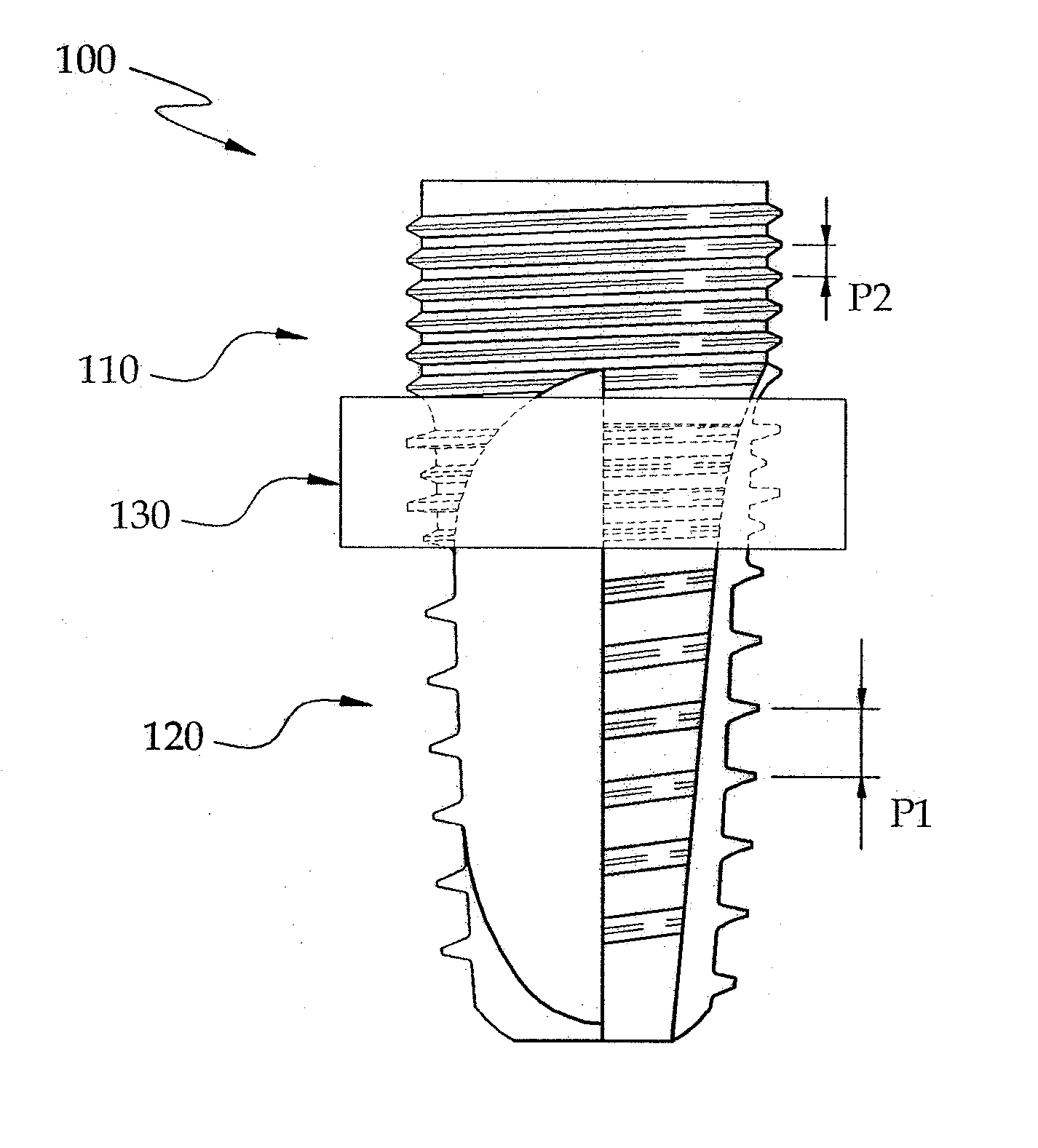 Fixture of dental implant and method of manufacturing the same