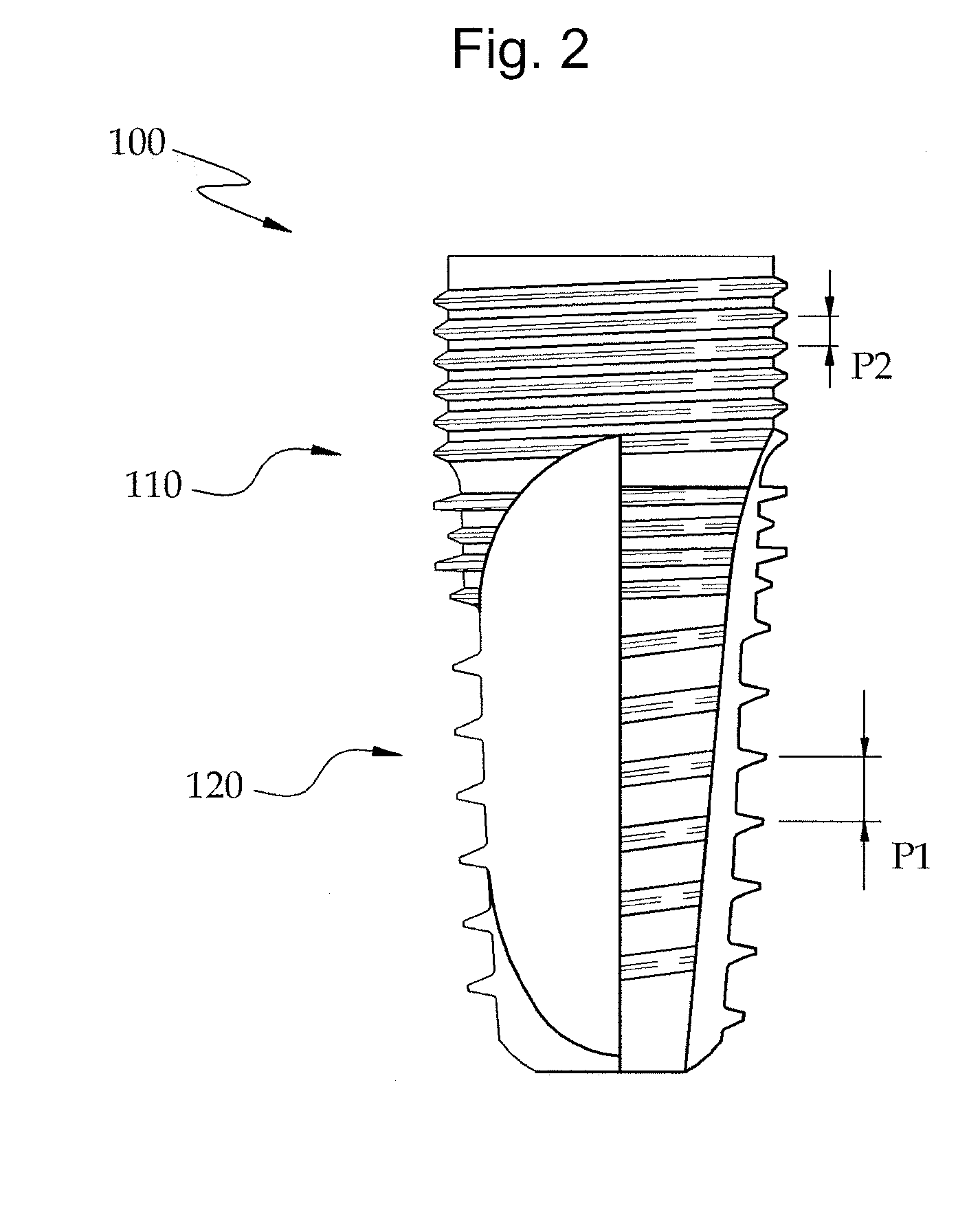 Fixture of dental implant and method of manufacturing the same