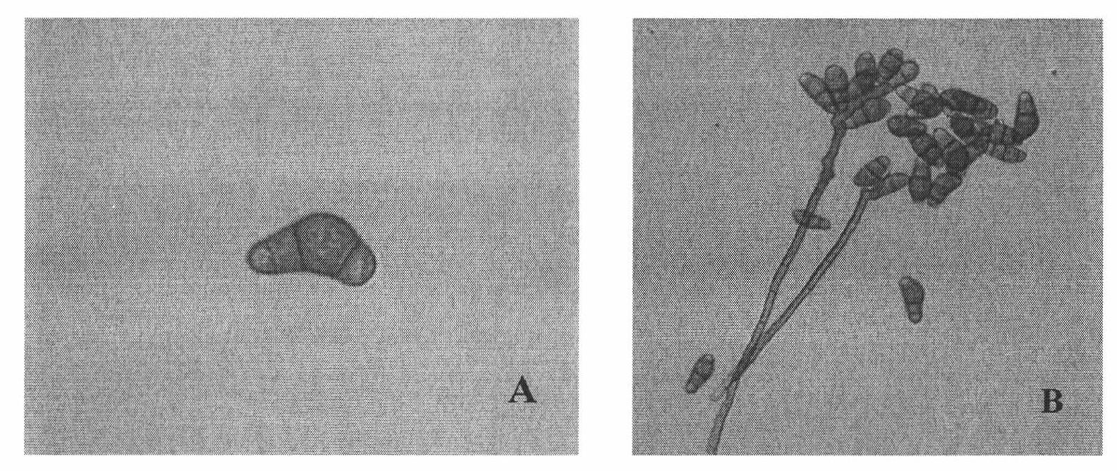 Curvularia lunata strain and application thereof