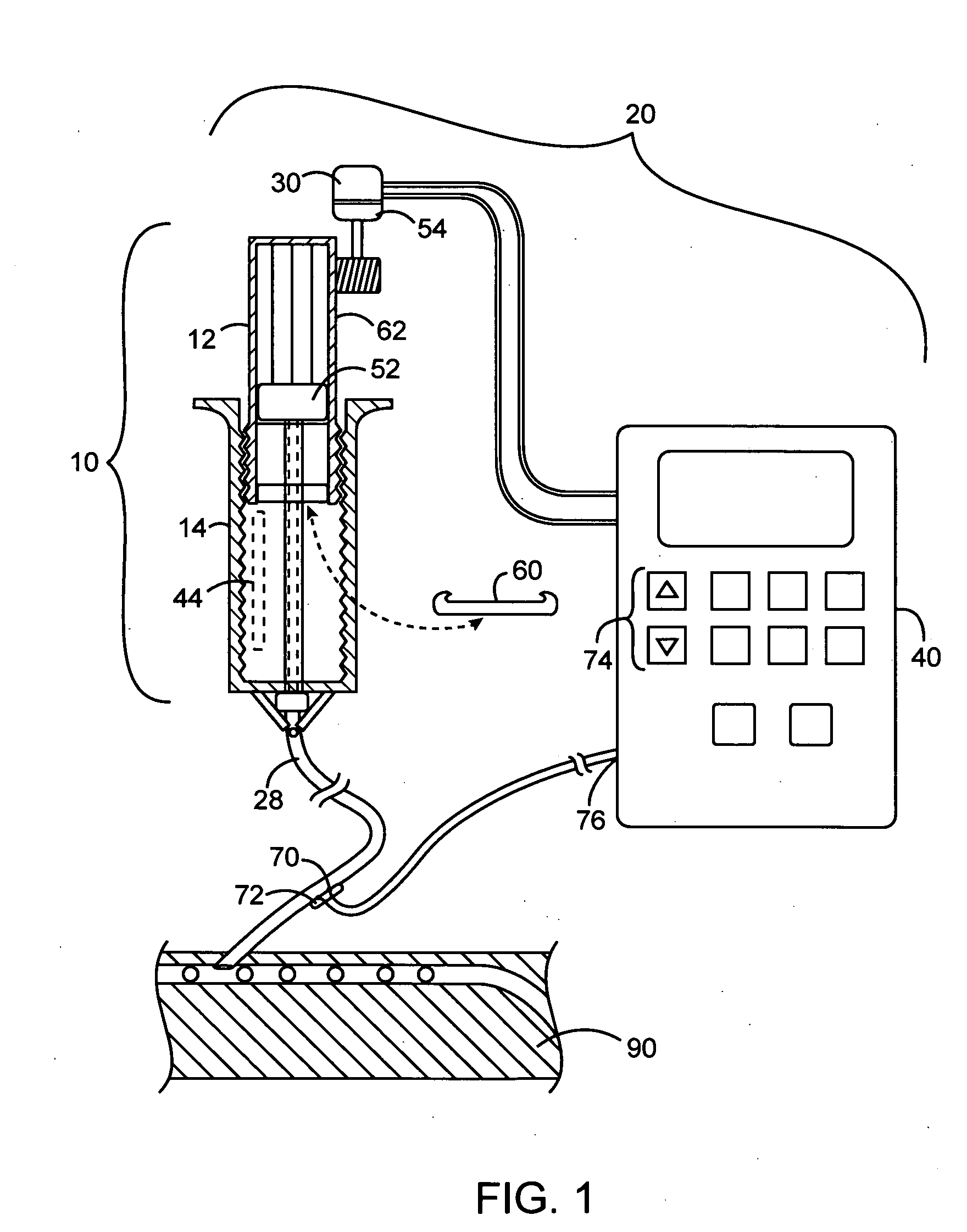 Quantitative chronological medical infusion device