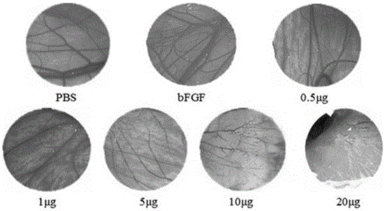 Application of lamprey crbgp in the preparation of anti-angiogenesis drugs