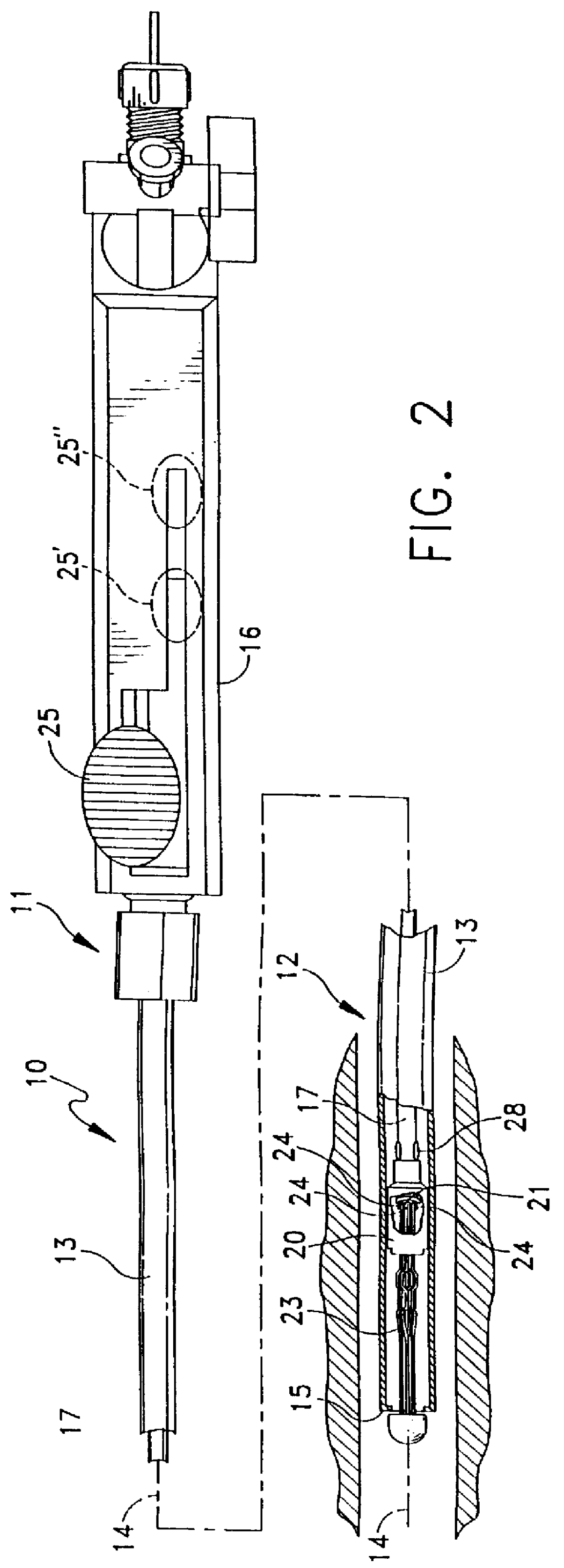 Vena cava delivery system