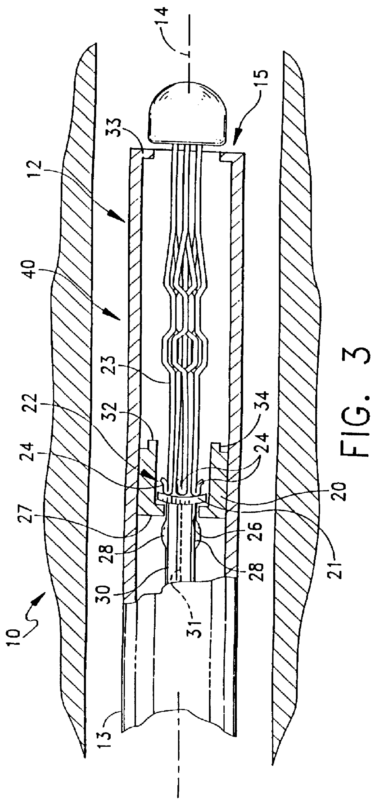 Vena cava delivery system