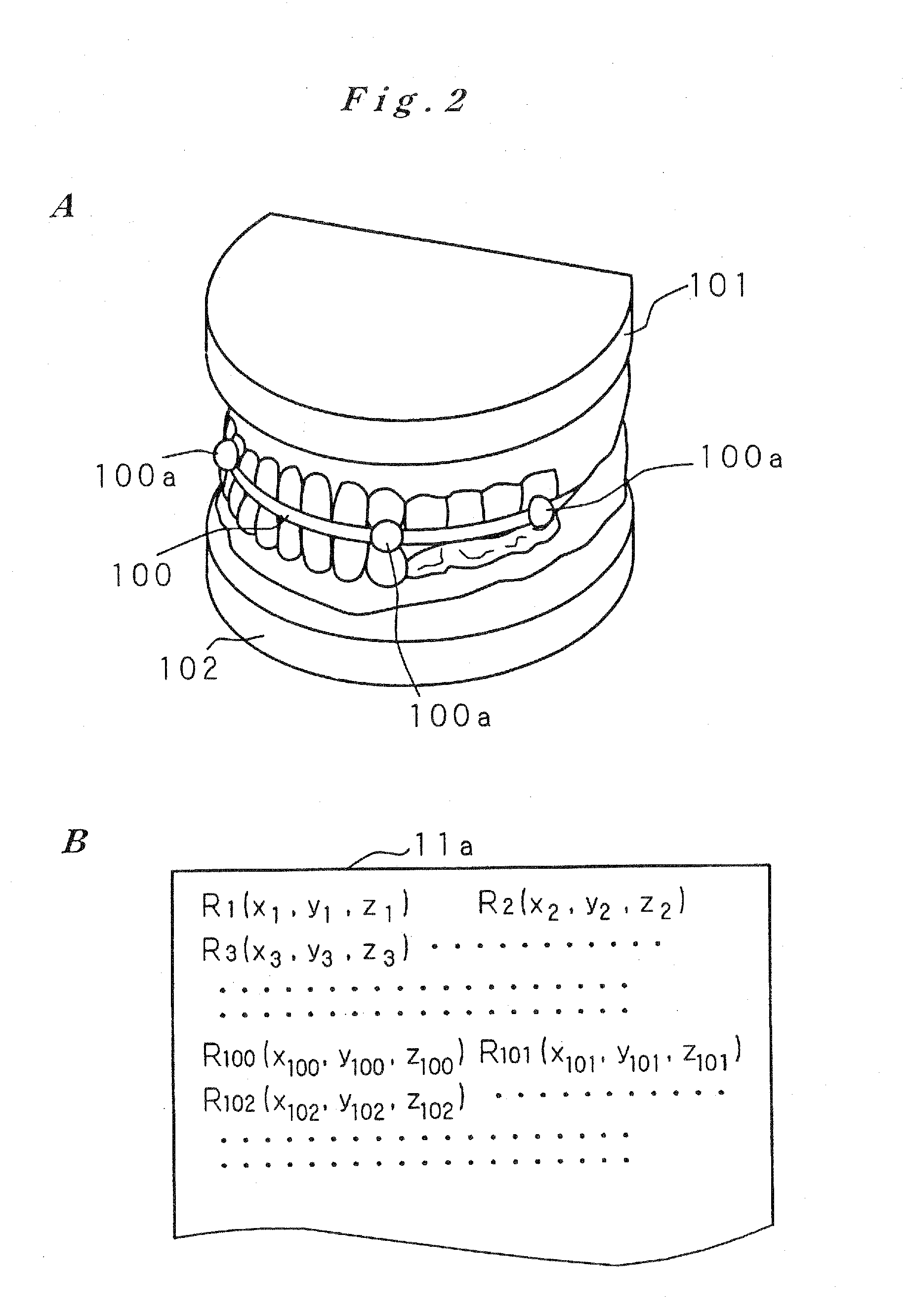 Artificial Tooth Root Implantation Position Determining Instrument, Artificial Tooth Root Implantation Position Determining Method, Guide Member Manufacturing Device, Sensor, Drill, Artificial Tooth Manufacturing Device, Computer Program, and Recording Medium