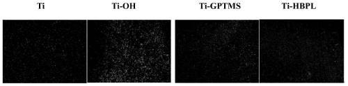 Titanium implant material with anti-infection and osseointegration promoting functions, and preparation method thereof