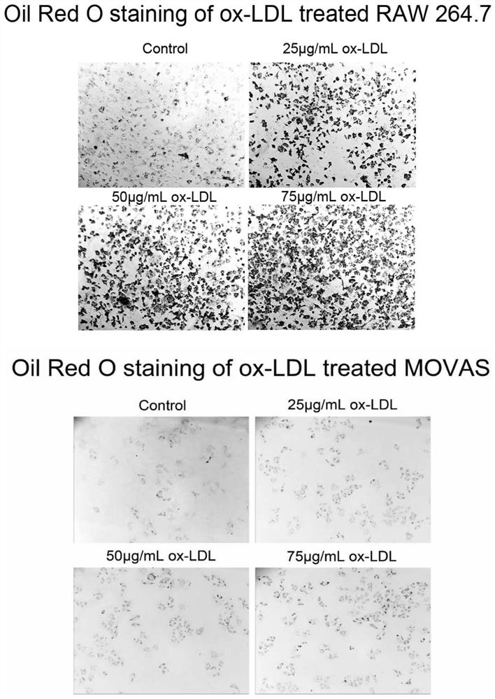 Fusion protein and application thereof