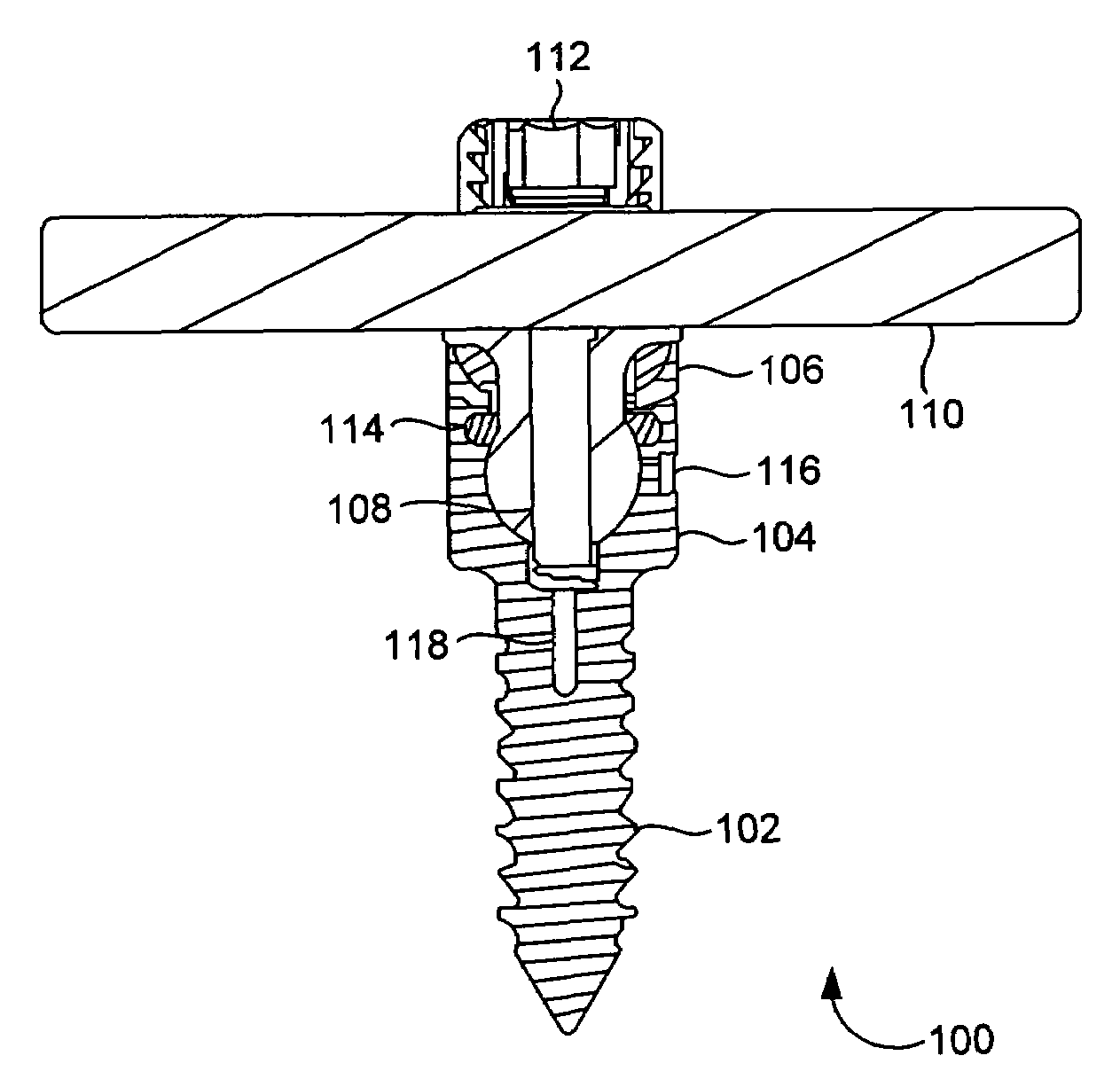 Sealed lubrication system and method for dynamic stabilization system