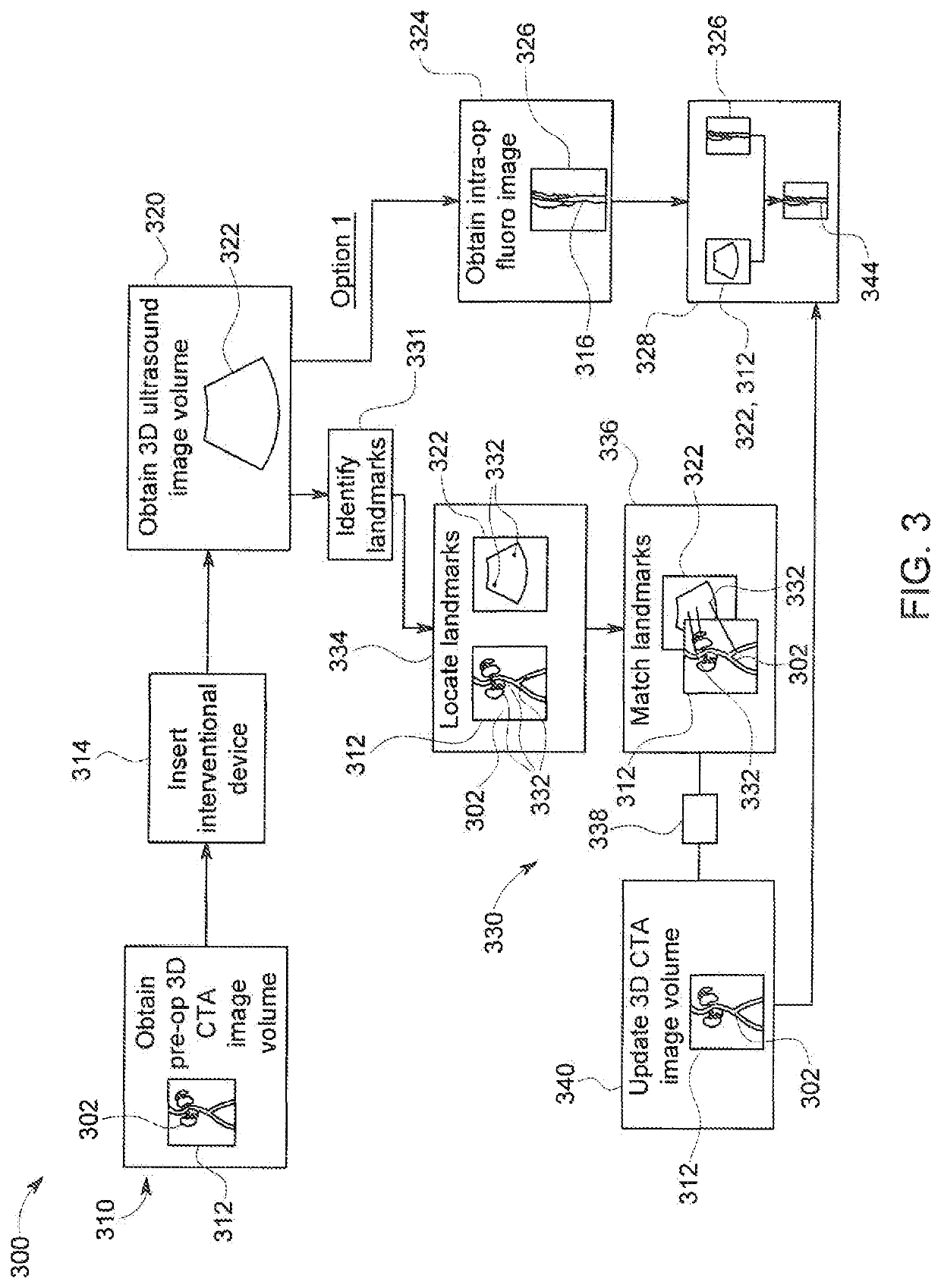 Combination of 3D ultrasound and computed tomography for guidance in interventional medical procedures