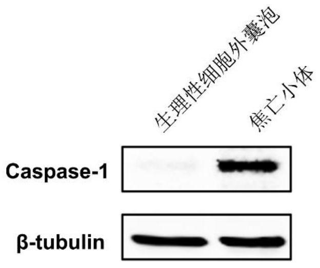 Method for preparing extracellular vesicles and application of extracellular vesicles