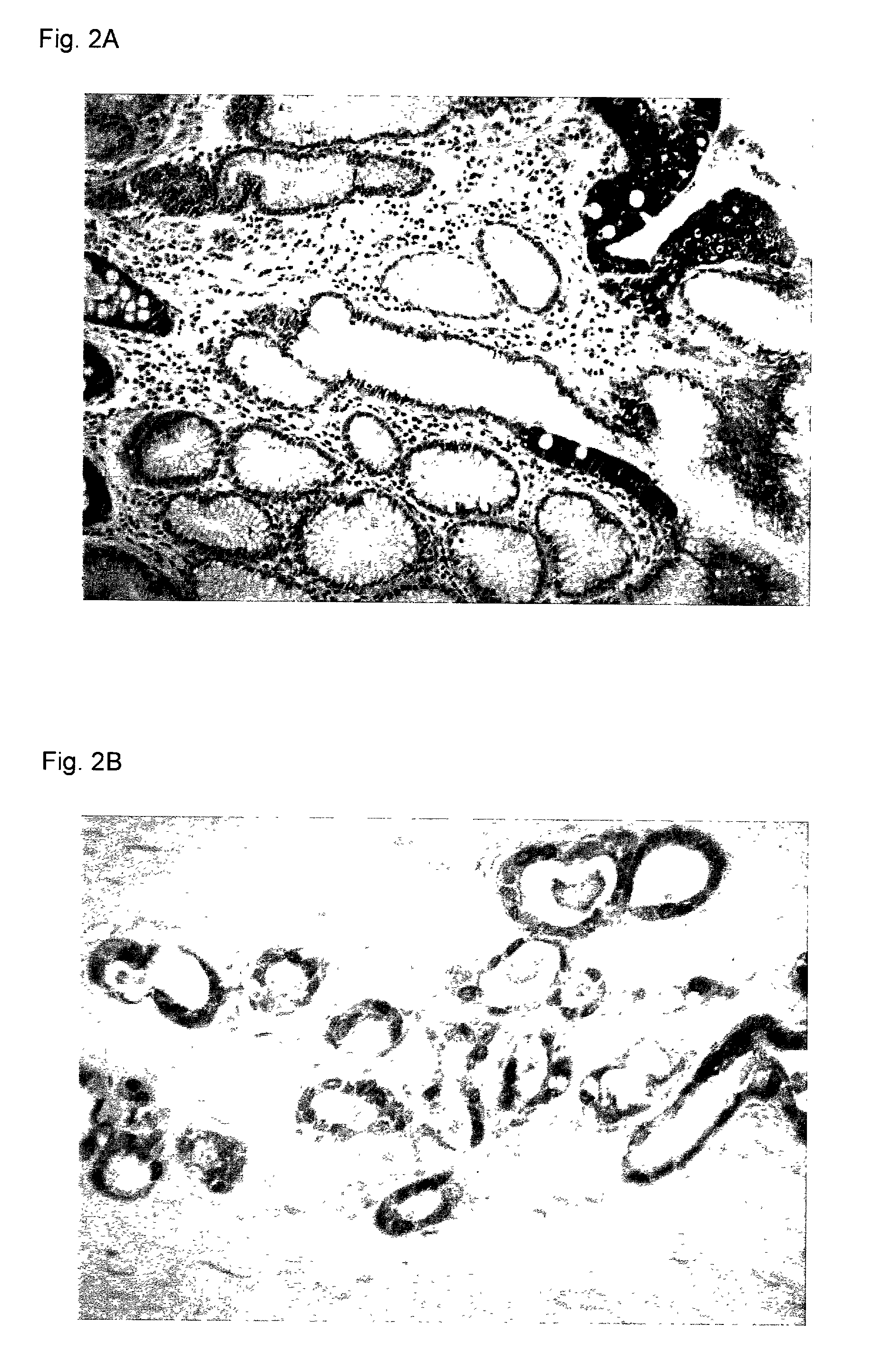 Method and kit for predicting cancer