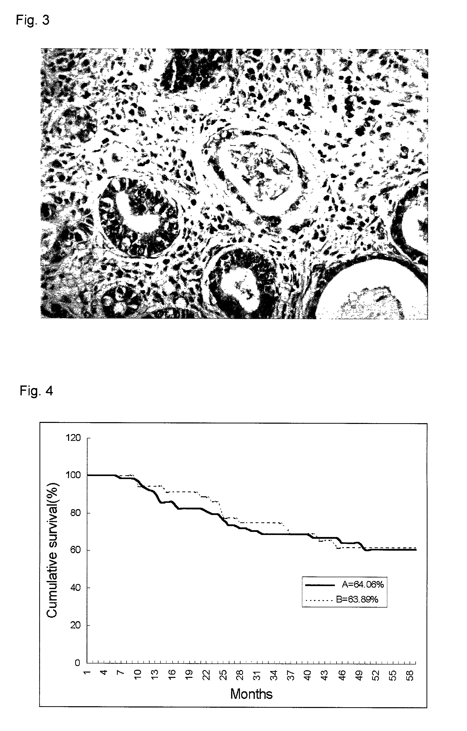 Method and kit for predicting cancer