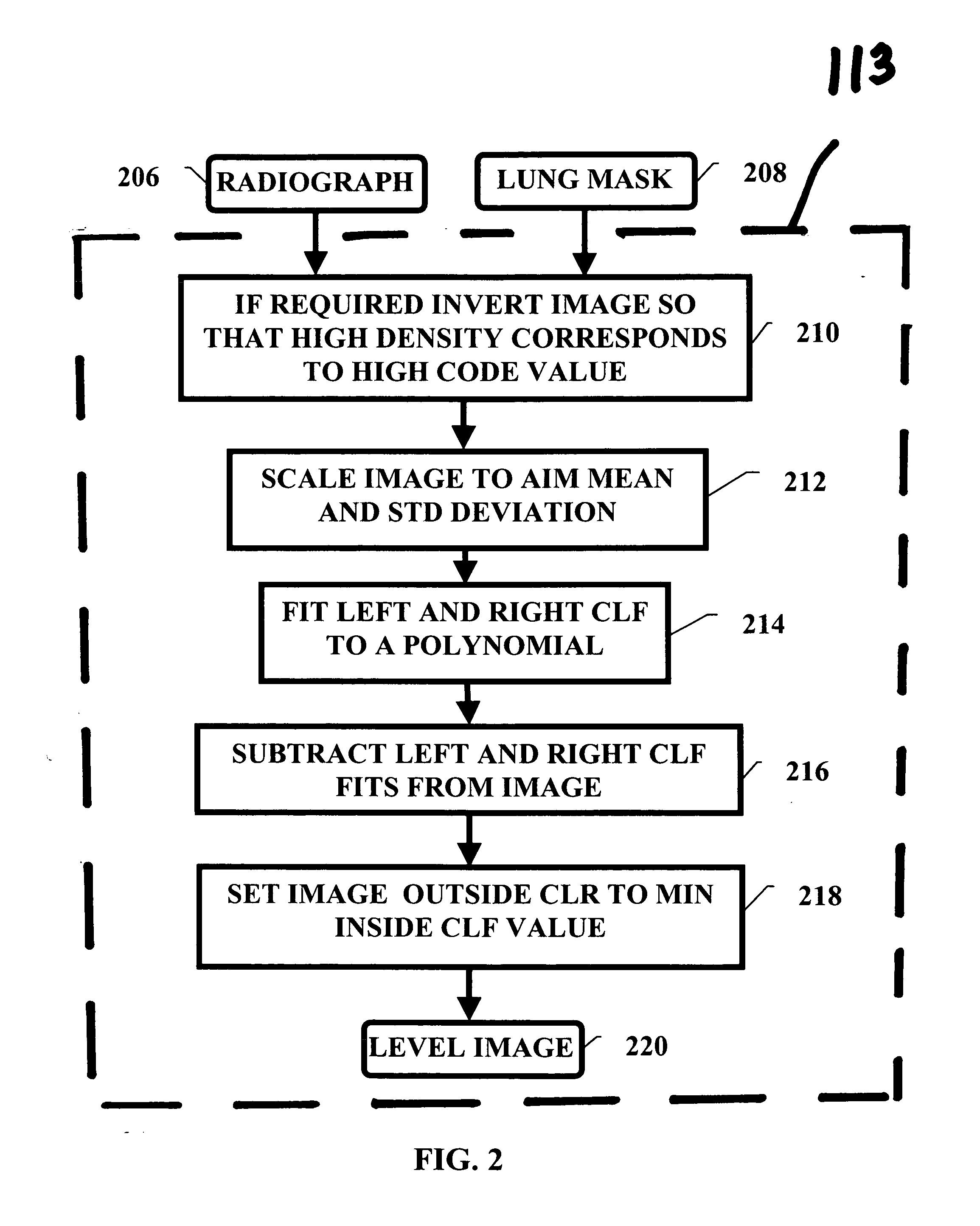 Pulminary nodule detection in a chest radiograph