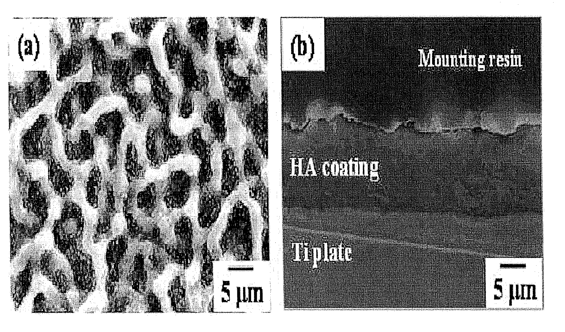 Preparation method of hydroxyapatite coating layer using aerosol deposition and hydrothermal treatment, and nanostructured hydroxyapatite coating layer prepared by the method