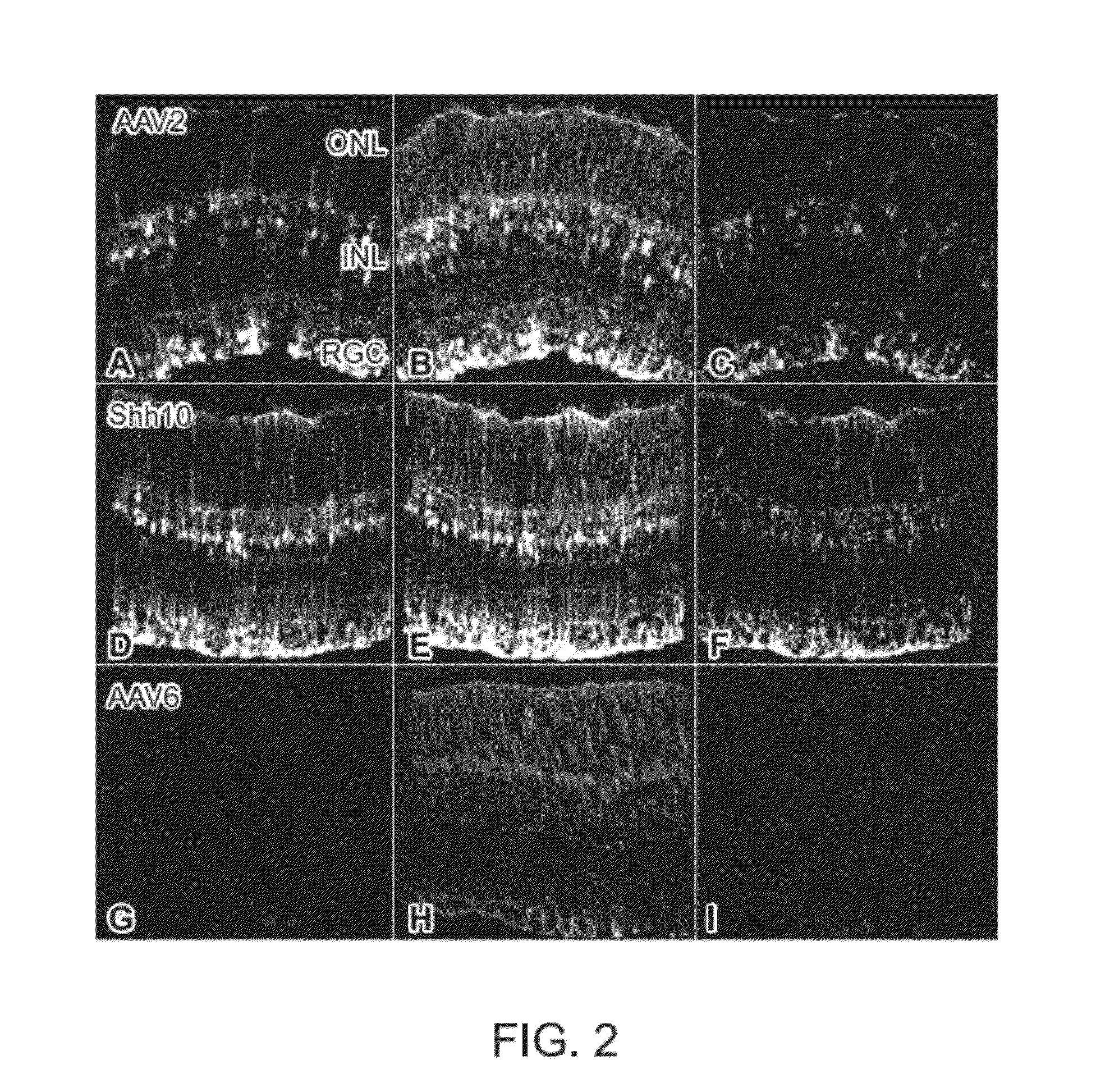 Adeno-associated virus virions with variant capsid and methods of use thereof