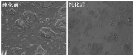 Coating buffer and separation culture method of primary tumor cells